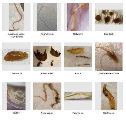 Why You Don’t See Parasites During a Cleanse (And Why That’s Actually a Good Sign)